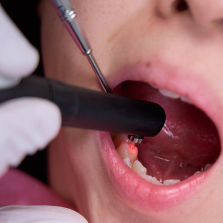 ダイアグノデント